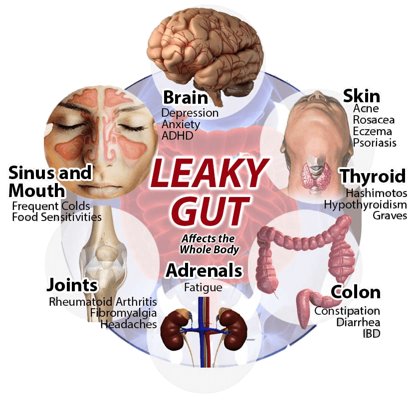 Leaky Gut & Colon Issues