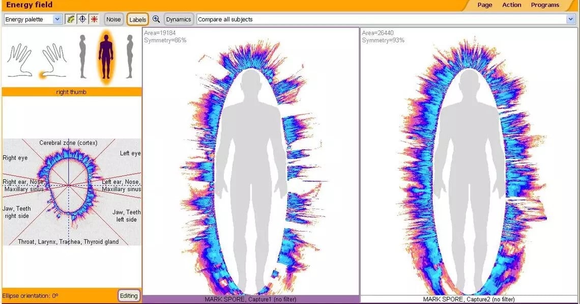 GDV Biofield Scan Results