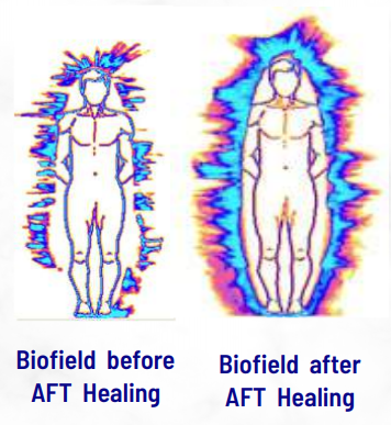 AFT Biofield before & after